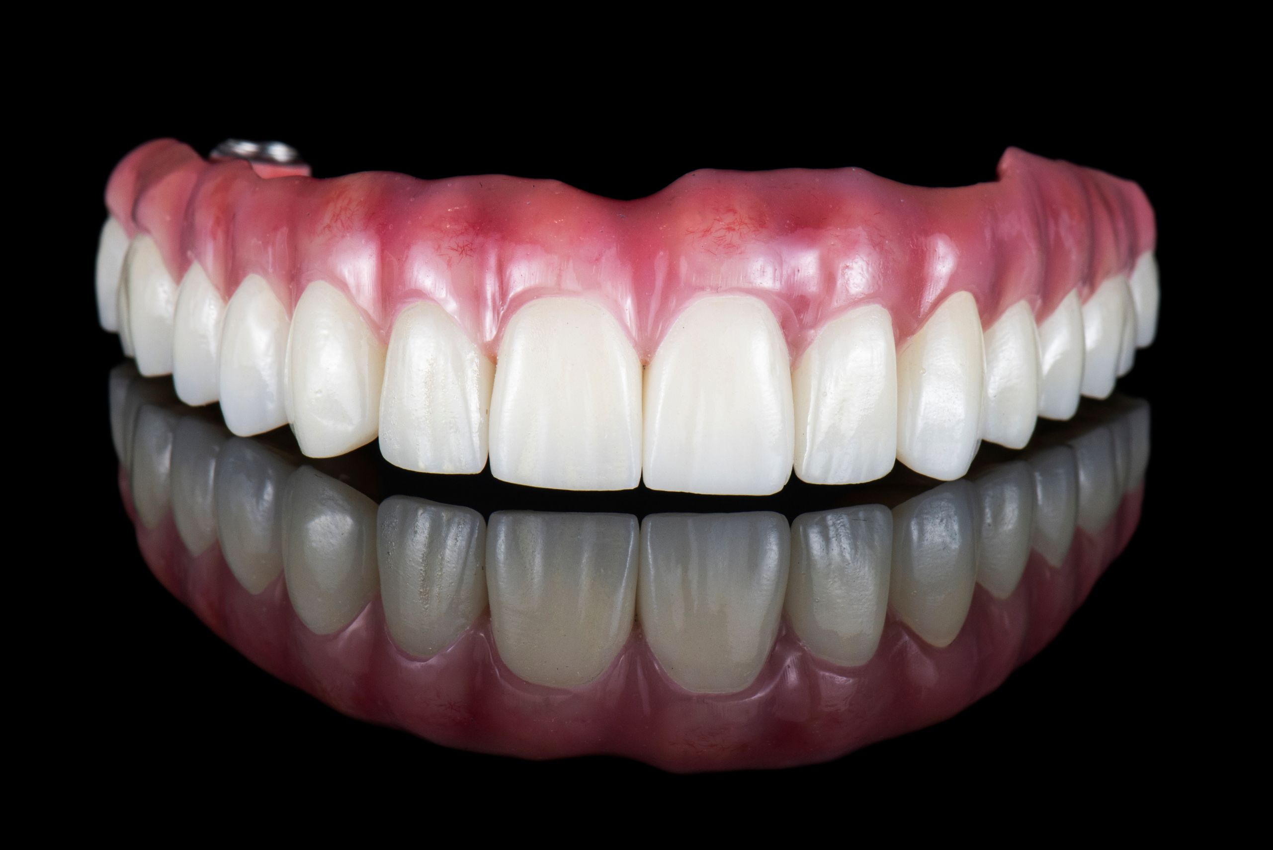 Why Choose Dental Implants Over Traditional Dentures in Edinburgh