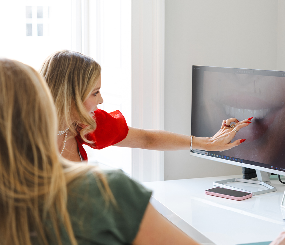 porcelain veneers before and after In Edinburgh